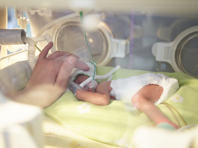 Warum hat mein Frühchen eine Hirnblutung?