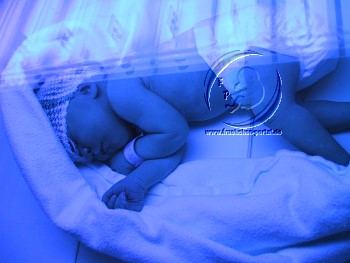 Hyperbilirubinämie - Gelbsucht beim Frühgeborenen und Neugeborenen