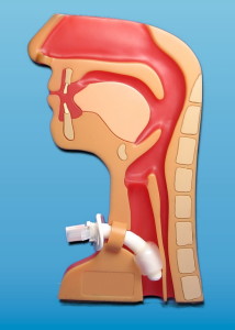 tracheotomie