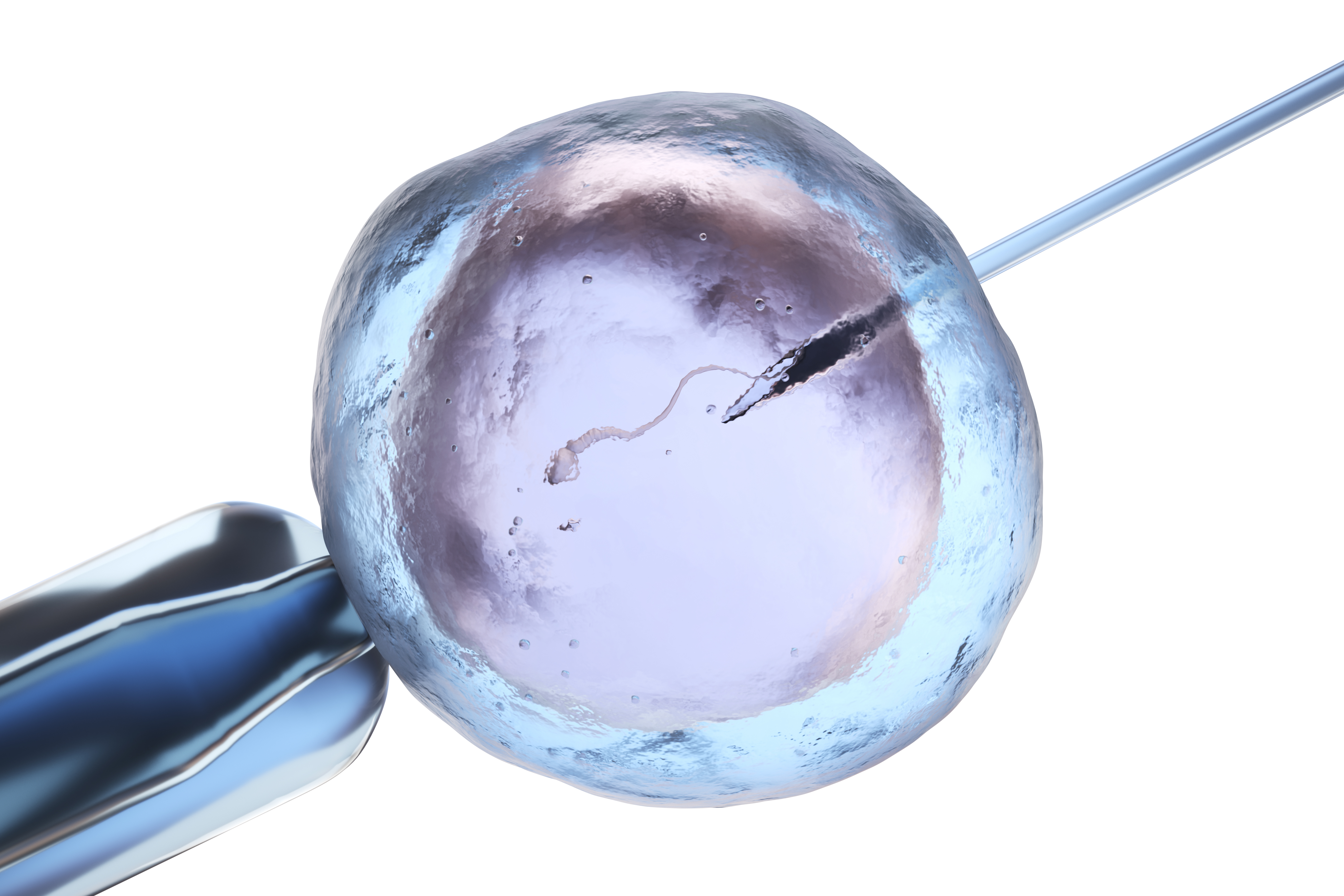 künstliche Befruchtung ICSI,  IVF